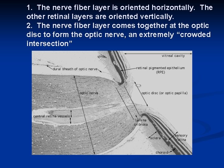 1. The nerve fiber layer is oriented horizontally. The other retinal layers are oriented