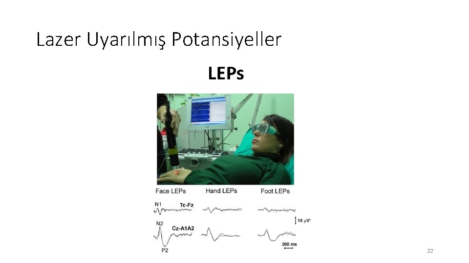 Lazer Uyarılmış Potansiyeller 22 