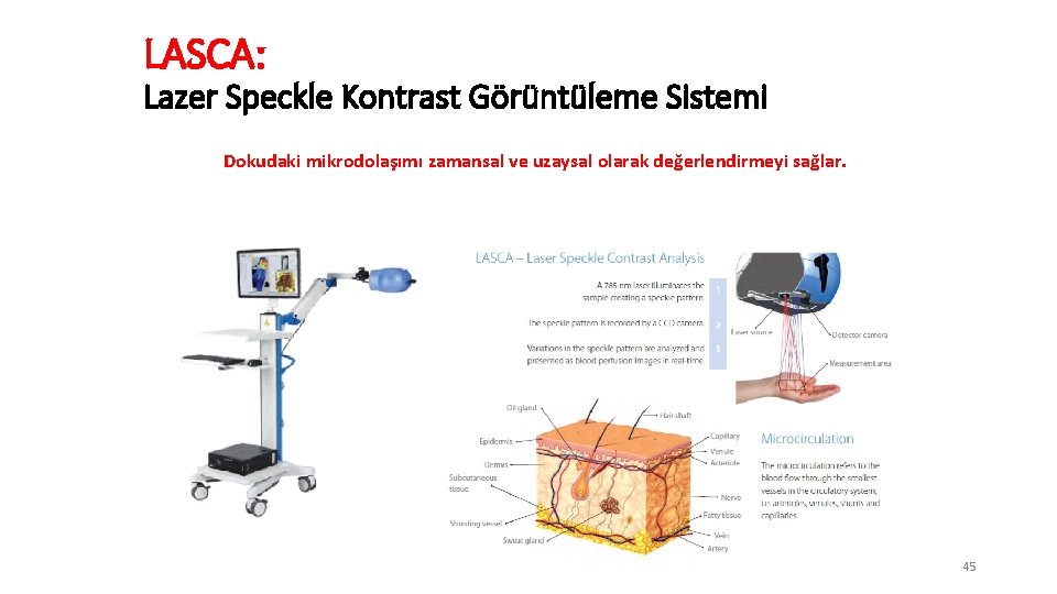 LASCA: Lazer Speckle Kontrast Görüntüleme Sistemi Dokudaki mikrodolaşımı zamansal ve uzaysal olarak değerlendirmeyi sağlar.