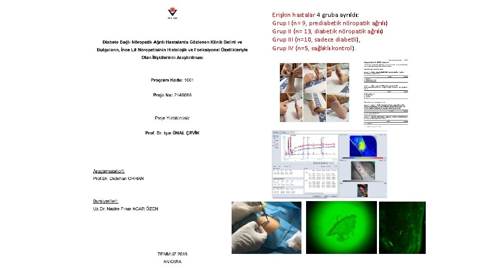 Erişkin hastalar 4 gruba ayrıldı: Grup I (n= 9, prediabetik nöropatik ağrılı) Grup II