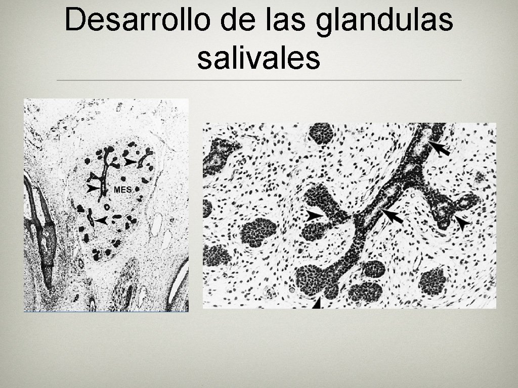 Desarrollo de las glandulas salivales 