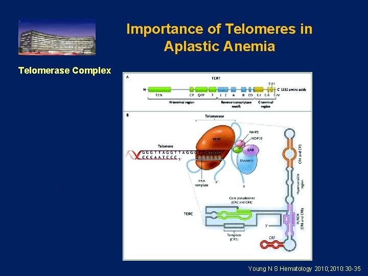 Importance of Telomeres in Aplastic Anemia Telomerase Complex . Young N S Hematology 2010;