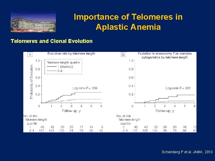 Importance of Telomeres in Aplastic Anemia Telomeres and Clonal Evolution . Scheinberg P et