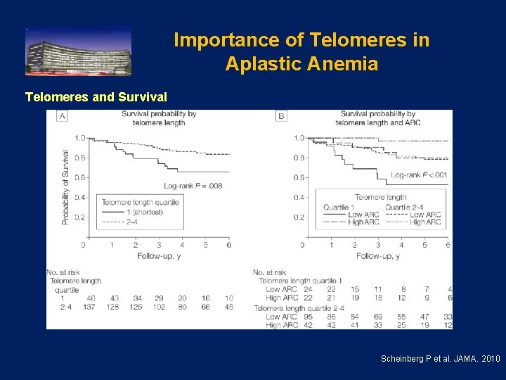 Importance of Telomeres in Aplastic Anemia Telomeres and Survival . Scheinberg P et al.