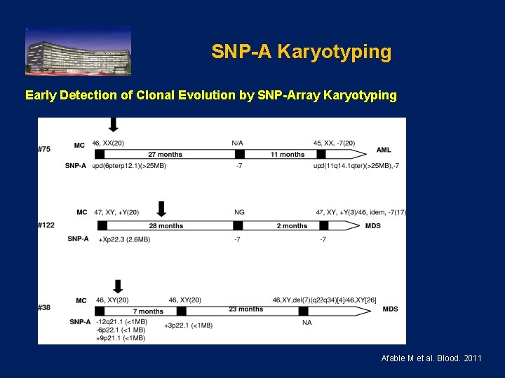 SNP-A Karyotyping Early Detection of Clonal Evolution by SNP-Array Karyotyping Afable M et al.