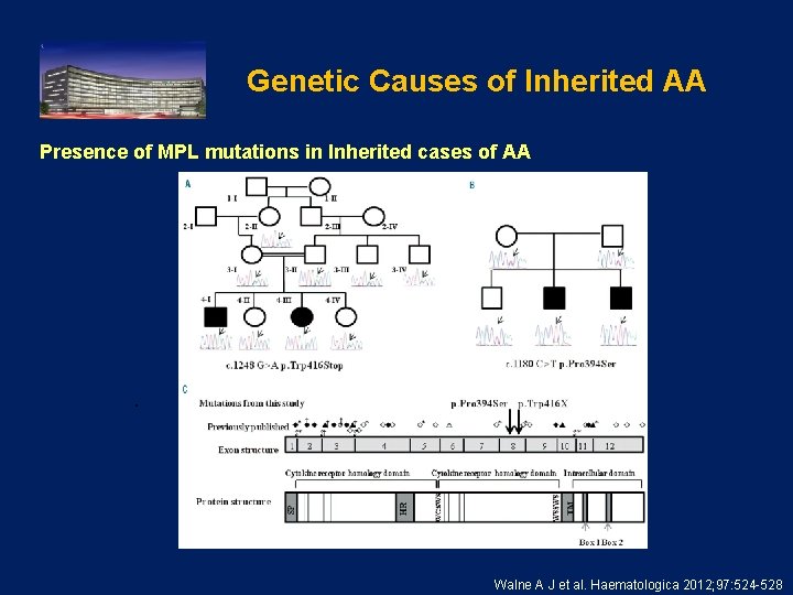 Genetic Causes of Inherited AA Presence of MPL mutations in Inherited cases of AA