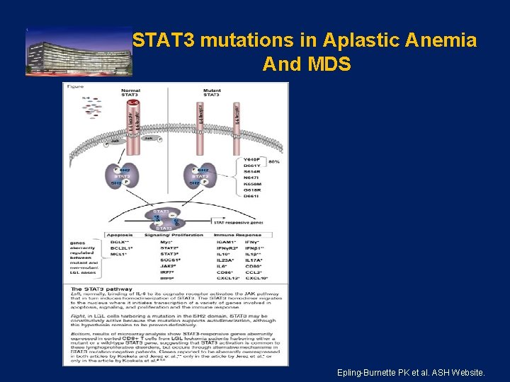 STAT 3 mutations in Aplastic Anemia And MDS . Epling-Burnette PK et al. ASH