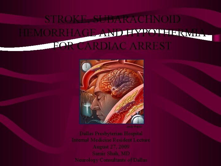 STROKE, SUBARACHNOID HEMORRHAGE AND HYPOTHERMIA FOR CARDIAC ARREST -Andy Rekito Dallas Presbyterian Hospital Internal