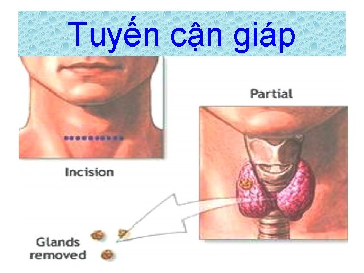 Tuyến cận giáp 