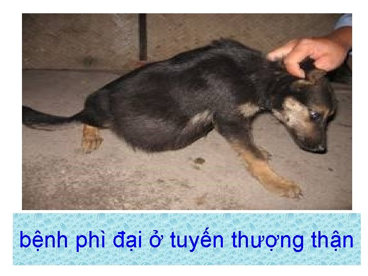 bệnh phì đại ở tuyến thượng thận 