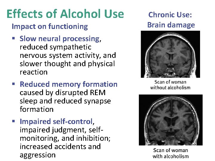 Effects of Alcohol Use Impact on functioning § Slow neural processing, reduced sympathetic nervous