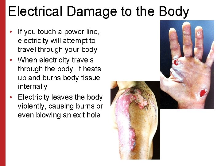 Electrical Damage to the Body • If you touch a power line, electricity will