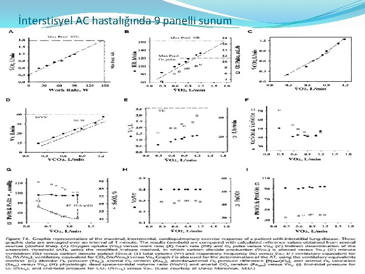 İnterstisyel AC hastalığında 9 panelli sunum 
