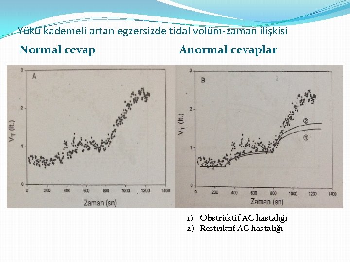 Yükü kademeli artan egzersizde tidal volüm-zaman ilişkisi Normal cevap Anormal cevaplar 1) Obstrüktif AC