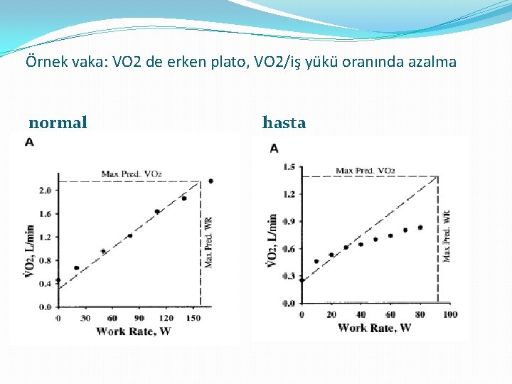 Örnek vaka: VO 2 de erken plato, VO 2/iş yükü oranında azalma normal hasta