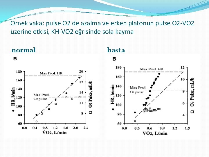 Örnek vaka: pulse O 2 de azalma ve erken platonun pulse O 2 -VO