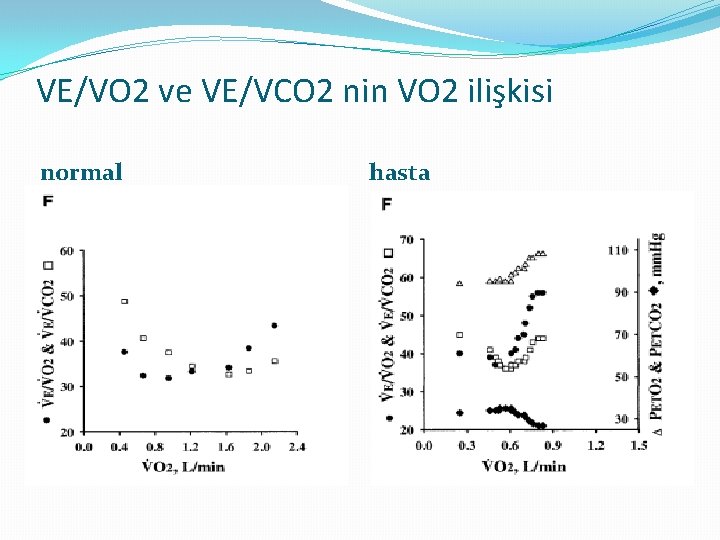 VE/VO 2 ve VE/VCO 2 nin VO 2 ilişkisi normal hasta 