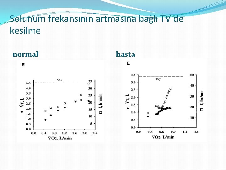 Solunum frekansının artmasına bağlı TV de kesilme normal hasta 