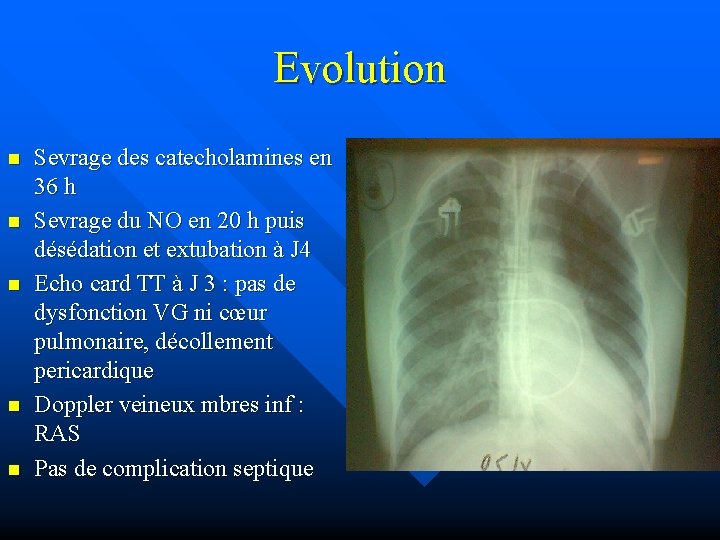 Evolution n n Sevrage des catecholamines en 36 h Sevrage du NO en 20