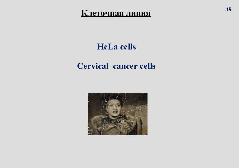 Клеточная линия He. La cells Cervical cancer cells 18 