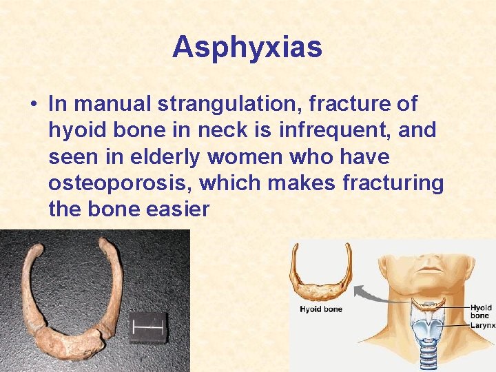 Asphyxias • In manual strangulation, fracture of hyoid bone in neck is infrequent, and