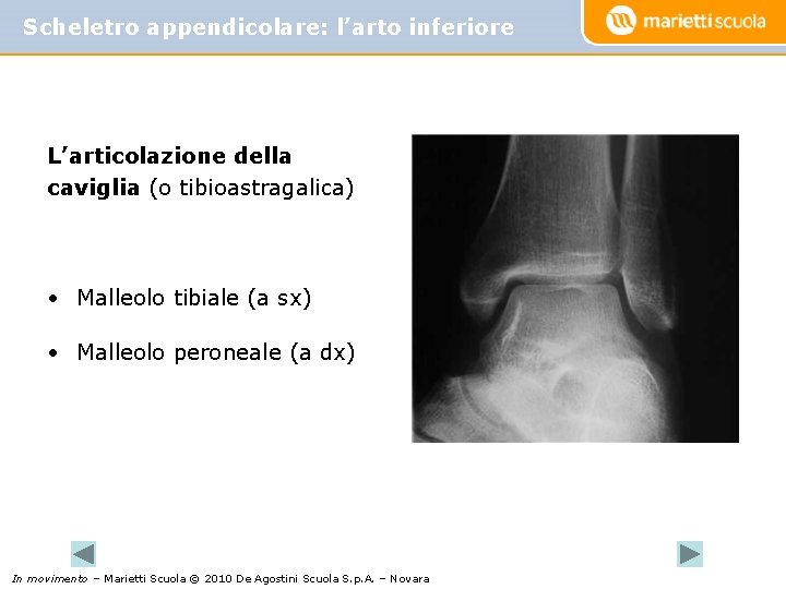 Scheletro appendicolare: l’arto inferiore L’articolazione della caviglia (o tibioastragalica) • Malleolo tibiale (a sx)