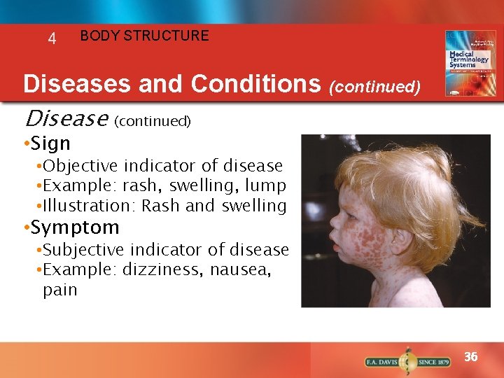 4 BODY STRUCTURE Diseases and Conditions (continued) Disease • Sign (continued) • Objective indicator 4 BODY STRUCTURE Diseases and Conditions (continued) Disease • Sign (continued) • Objective indicator