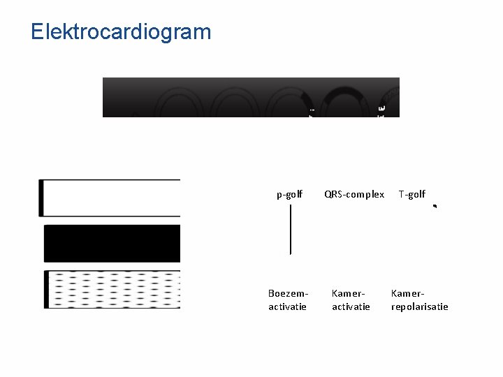 Elektrocardiogram p-golf QRS-complex Boezemactivatie Kameractivatie T-golf Kamerrepolarisatie 