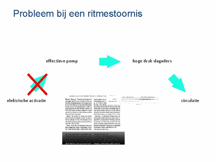 Probleem bij een ritmestoornis effectieve pomp elektrische activatie hoge druk slagaders circulatie 
