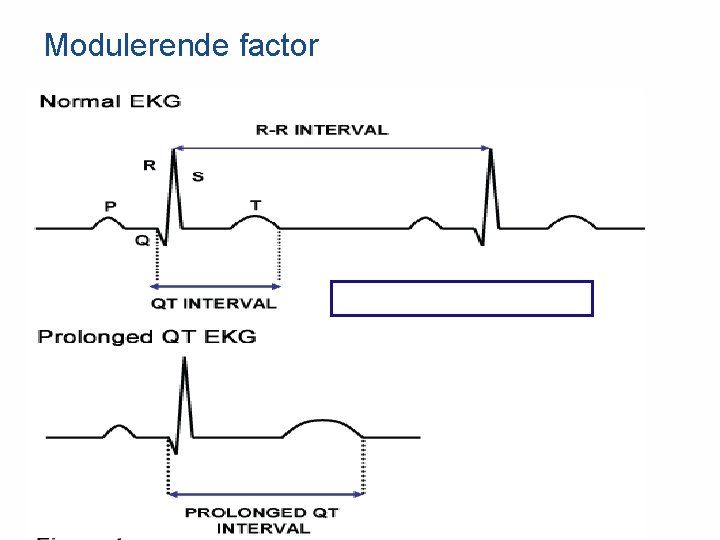 Modulerende factor 