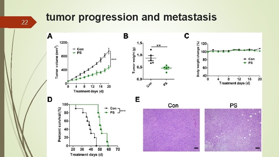 22 tumor progression and metastasis 