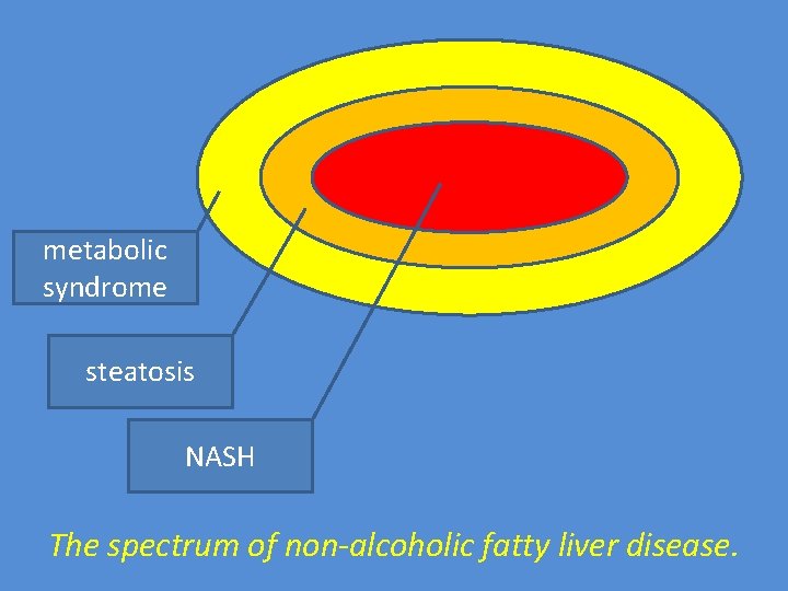 metabolic syndrome steatosis NASH The spectrum of non-alcoholic fatty liver disease. 