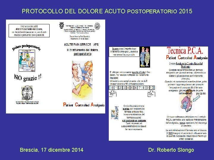 PROTOCOLLO DEL DOLORE ACUTO POSTOPERATORIO 2015 Brescia, 17 dicembre 2014 Dr. Roberto Slongo 