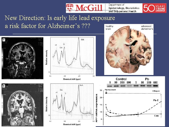 New Direction: Is early life lead exposure a risk factor for Alzheimer’s ? ?