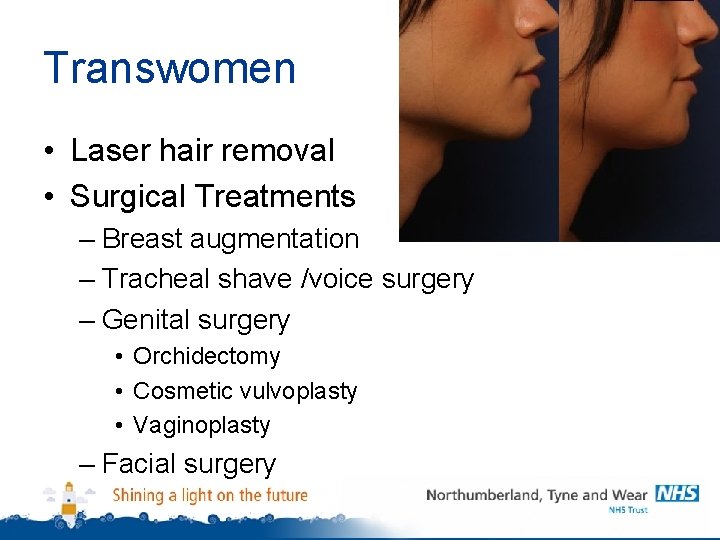 Transwomen • Laser hair removal • Surgical Treatments – Breast augmentation – Tracheal shave