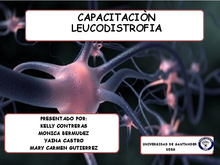 CAPACITACIÒN LEUCODISTROFIA PRESENTADO POR: KELLY CONTRERAS MONICA BERMUDEZ YAINA CASTRO MARY CARMEN GUTIERREZ UNIVERSIDAD