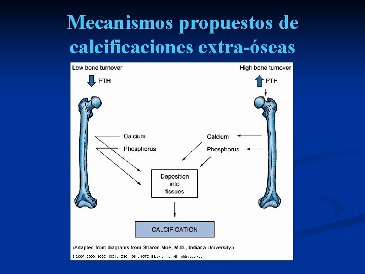 Mecanismos propuestos de calcificaciones extra-óseas Mecanismos propuestos de calcificaciones extra-óseas
