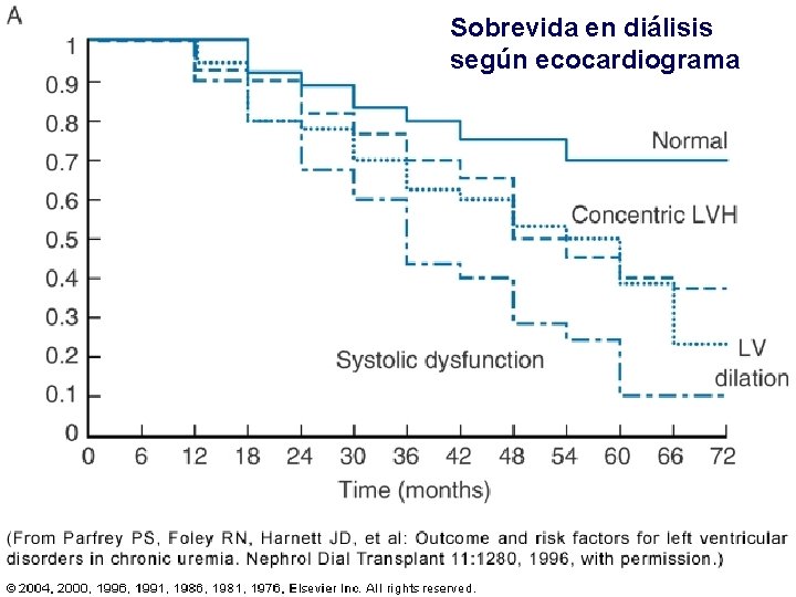 Sobrevida en diálisis según ecocardiograma Sobrevida en diálisis según ecocardiograma