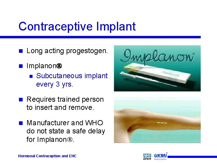 Contraceptive Implant n Long acting progestogen. n Implanon n Subcutaneous implant every 3 yrs.