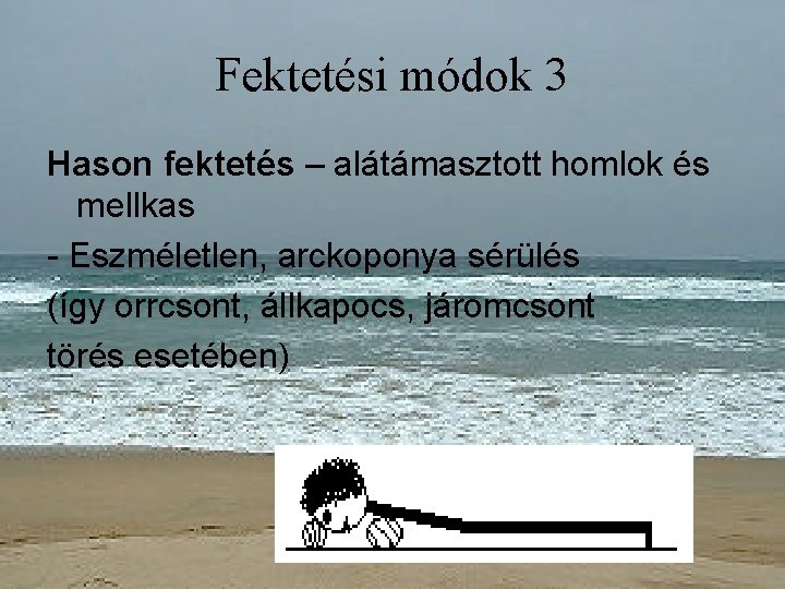 Fektetési módok 3 Hason fektetés – alátámasztott homlok és mellkas - Eszméletlen, arckoponya sérülés