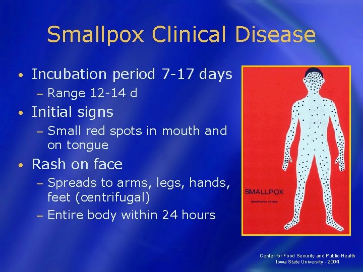 Smallpox Clinical Disease • Incubation period 7 -17 days − • Initial signs −
