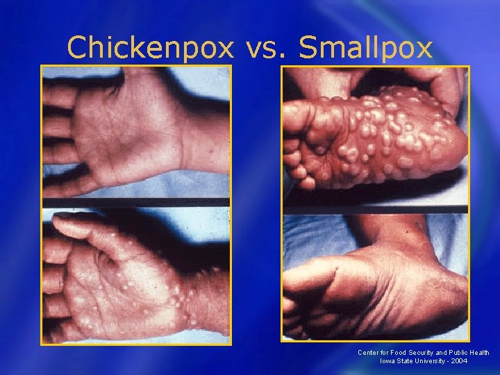 Chickenpox vs. Smallpox Center for Food Security and Public Health Iowa State University -
