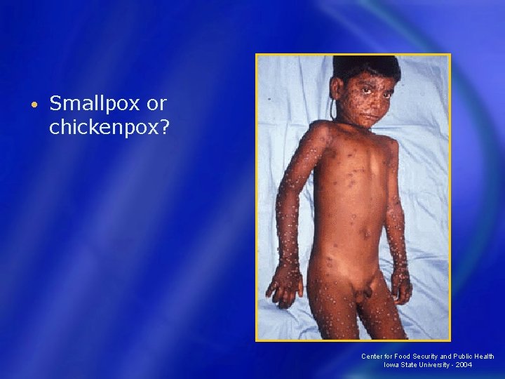  • Smallpox or chickenpox? Center for Food Security and Public Health Iowa State