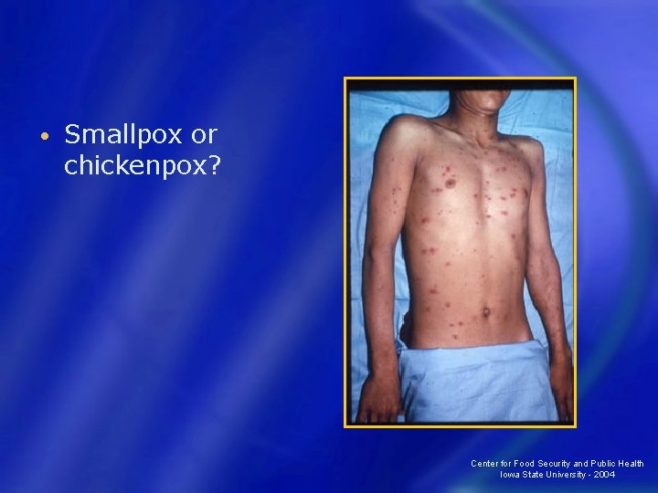  • Smallpox or chickenpox? Center for Food Security and Public Health Iowa State