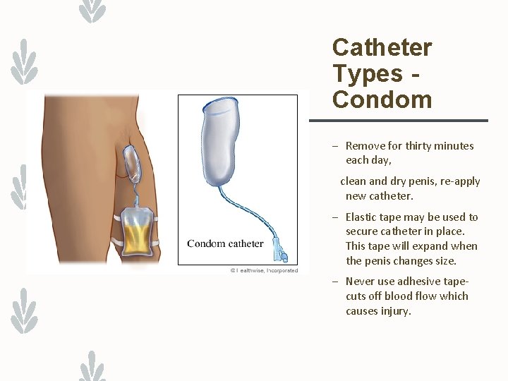 Catheter Types Condom – Remove for thirty minutes each day, clean and dry penis,