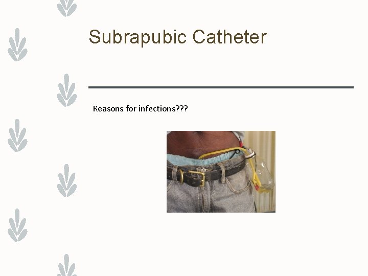 Subrapubic Catheter Reasons for infections? ? ? 