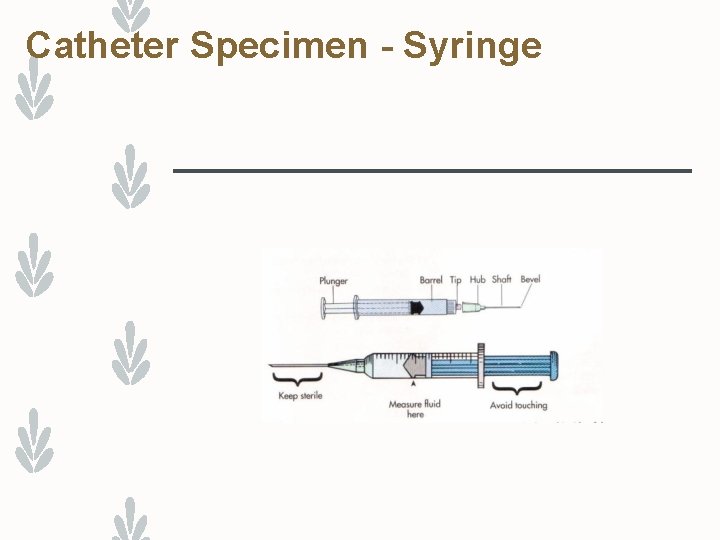 Catheter Specimen - Syringe 