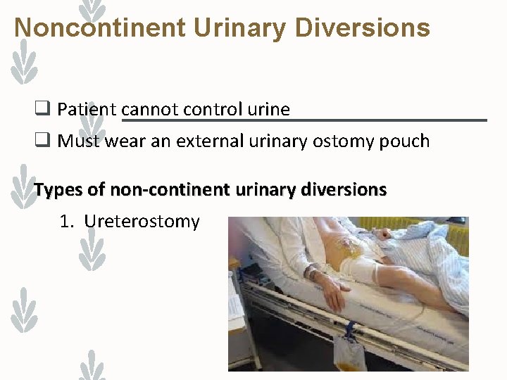 Noncontinent Urinary Diversions q Patient cannot control urine q Must wear an external urinary