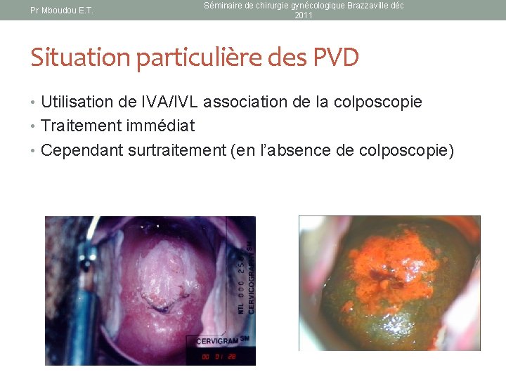 Pr Mboudou E. T. Séminaire de chirurgie gynécologique Brazzaville déc 2011 Situation particulière des