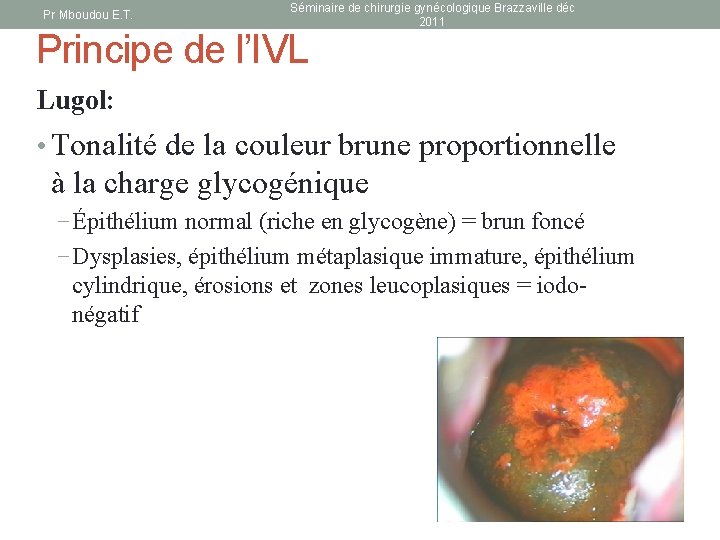 Pr Mboudou E. T. Séminaire de chirurgie gynécologique Brazzaville déc 2011 Principe de l’IVL
